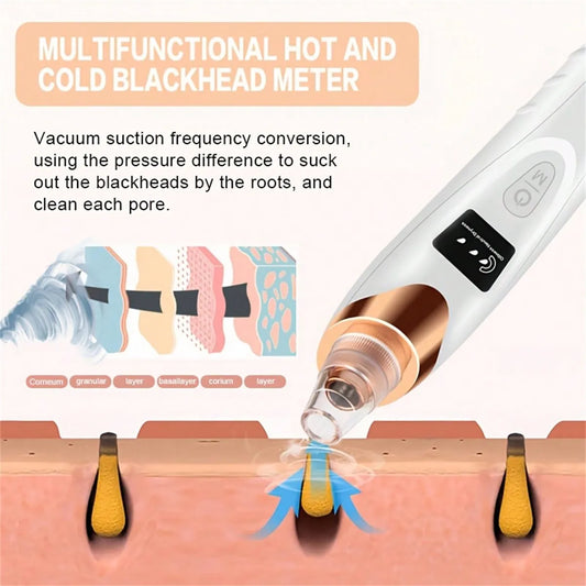 Aspirador de poros eliminador de espinillas de 5 potencia de succión, aspirador de poros eliminador de espinillas para mujeres, Kit de limpiador de poros faciales para herramienta extractora para adultos