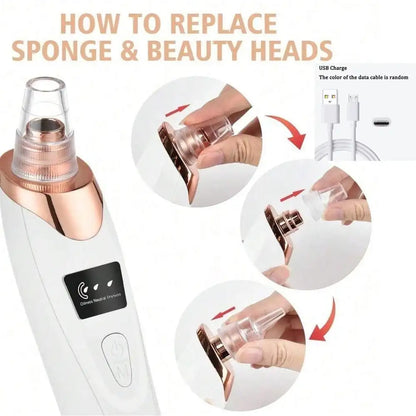 5-Level Suction Pore Vacuum Blackhead Remover – Electric Facial Pore Cleanser Kit for Women & Adults
